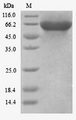 KLC3 Protein - (Tris-Glycine gel) Discontinuous SDS-PAGE (reduced) with 5% enrichment gel and 15% separation gel.