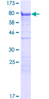 KLC3 Protein - 12.5% SDS-PAGE of human KLC3 stained with Coomassie Blue