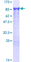 KLC4 Protein - 12.5% SDS-PAGE of human KLC4 stained with Coomassie Blue