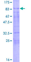 KLF11 Protein - 12.5% SDS-PAGE of human KLF11 stained with Coomassie Blue