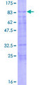 KLF11 Protein - 12.5% SDS-PAGE of human KLF11 stained with Coomassie Blue