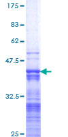 KLF11 Protein - 12.5% SDS-PAGE Stained with Coomassie Blue.
