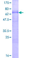 KLF12 Protein - 12.5% SDS-PAGE of human KLF12 stained with Coomassie Blue