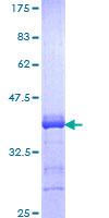 KLF12 Protein - 12.5% SDS-PAGE Stained with Coomassie Blue.