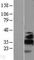 KLF13 Protein - Western validation with an anti-DDK antibody * L: Control HEK293 lysate R: Over-expression lysate