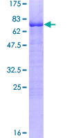 KLF15 Protein - 12.5% SDS-PAGE of human KLF15 stained with Coomassie Blue