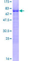 KLF15 Protein - 12.5% SDS-PAGE of human KLF15 stained with Coomassie Blue
