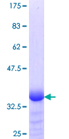 KLF15 Protein - 12.5% SDS-PAGE Stained with Coomassie Blue.