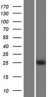 KLF16 Protein - Western validation with an anti-DDK antibody * L: Control HEK293 lysate R: Over-expression lysate