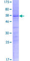 KLF16 Protein - 12.5% SDS-PAGE of human KLF16 stained with Coomassie Blue