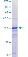 KLF2 Protein - 12.5% SDS-PAGE Stained with Coomassie Blue.