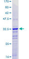 KLF2 Protein - 12.5% SDS-PAGE Stained with Coomassie Blue.