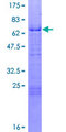 KLF3 Protein - 12.5% SDS-PAGE of human KLF3 stained with Coomassie Blue