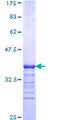 KLF3 Protein - 12.5% SDS-PAGE Stained with Coomassie Blue.