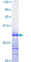 KLF4 Protein - 12.5% SDS-PAGE Stained with Coomassie Blue.