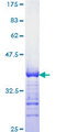 KLF4 Protein - 12.5% SDS-PAGE Stained with Coomassie Blue.