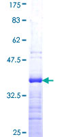 KLF5 / BTEB2 Protein - 12.5% SDS-PAGE Stained with Coomassie Blue.