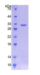 KLF5 / BTEB2 Protein - Recombinant  Kruppel Like Factor 5, Intestinal By SDS-PAGE
