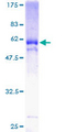 KLF6 Protein - 12.5% SDS-PAGE of human KLF6 stained with Coomassie Blue
