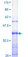 KLF6 Protein - 12.5% SDS-PAGE Stained with Coomassie Blue.