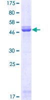 KLF7 Protein - 12.5% SDS-PAGE of human KLF7 stained with Coomassie Blue