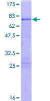 KLF8 Protein - 12.5% SDS-PAGE of human KLF8 stained with Coomassie Blue