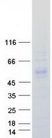 KLHDC1 Protein - Purified recombinant protein KLHDC1 was analyzed by SDS-PAGE gel and Coomassie Blue Staining