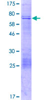 KLHDC10 Protein - 12.5% SDS-PAGE of human KIAA0265 stained with Coomassie Blue