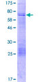 KLHDC10 Protein - 12.5% SDS-PAGE of human KIAA0265 stained with Coomassie Blue
