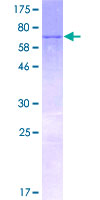KLHDC2 / LCP Protein - 12.5% SDS-PAGE of human KLHDC2 stained with Coomassie Blue