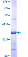 KLHDC3 Protein - 12.5% SDS-PAGE Stained with Coomassie Blue.