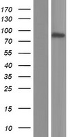KLHDC7A Protein - Western validation with an anti-DDK antibody * L: Control HEK293 lysate R: Over-expression lysate