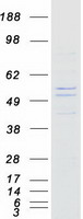 KLHDC7B Protein - Purified recombinant protein KLHDC7B was analyzed by SDS-PAGE gel and Coomassie Blue Staining