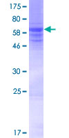 KLHDC8A Protein - 12.5% SDS-PAGE of human KLHDC8A stained with Coomassie Blue