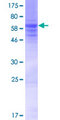 KLHDC8A Protein - 12.5% SDS-PAGE of human KLHDC8A stained with Coomassie Blue