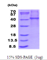 KLHDC8B Protein