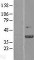 KLHDC9 Protein - Western validation with an anti-DDK antibody * L: Control HEK293 lysate R: Over-expression lysate