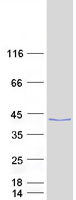 KLHDC9 Protein - Purified recombinant protein KLHDC9 was analyzed by SDS-PAGE gel and Coomassie Blue Staining