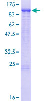 KLHL1 Protein - 12.5% SDS-PAGE of human KLHL1 stained with Coomassie Blue