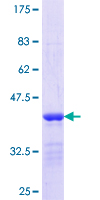 KLHL1 Protein - 12.5% SDS-PAGE Stained with Coomassie Blue.