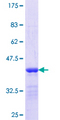 KLHL1 Protein - 12.5% SDS-PAGE Stained with Coomassie Blue.
