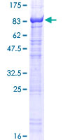 KLHL10 Protein - 12.5% SDS-PAGE of human KLHL10 stained with Coomassie Blue