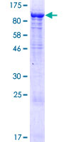 KLHL11 Protein - 12.5% SDS-PAGE of human KLHL11 stained with Coomassie Blue