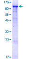 KLHL11 Protein - 12.5% SDS-PAGE of human KLHL11 stained with Coomassie Blue