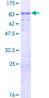 KLHL13 Protein - 12.5% SDS-PAGE of human KLHL13 stained with Coomassie Blue
