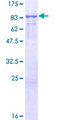 KLHL13 Protein - 12.5% SDS-PAGE of human KLHL13 stained with Coomassie Blue