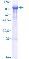 KLHL14 Protein - 12.5% SDS-PAGE of human KLHL14 stained with Coomassie Blue