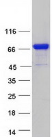 KLHL14 Protein - Purified recombinant protein KLHL14 was analyzed by SDS-PAGE gel and Coomassie Blue Staining