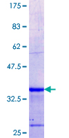 KLHL2 / MAV Protein - 12.5% SDS-PAGE Stained with Coomassie Blue.