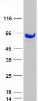 KLHL2 / MAV Protein - Purified recombinant protein KLHL2 was analyzed by SDS-PAGE gel and Coomassie Blue Staining